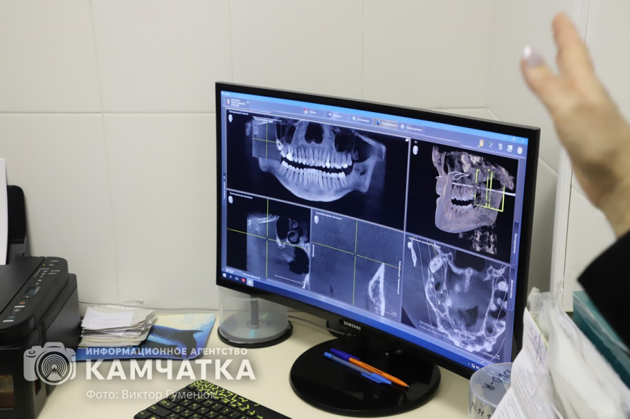 Насколько безопасно отбеливание зубов, рассказали врачи Камчатки. фото: Виктор Гуменюк