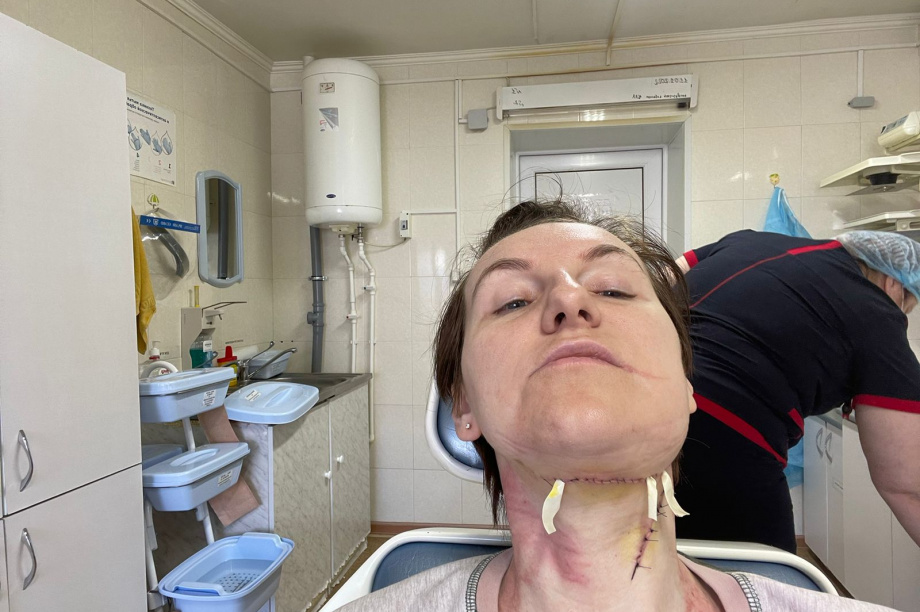 На Камчатке выжившая после флегмоны пациентка зубной клиники настаивает на возбуждении уголовного дела против врача. . Фотография 3